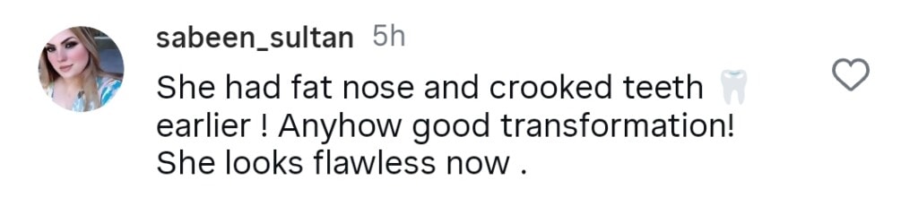 Ramsha Khan’s Old Clip Highlights her Cosmetic Procedures