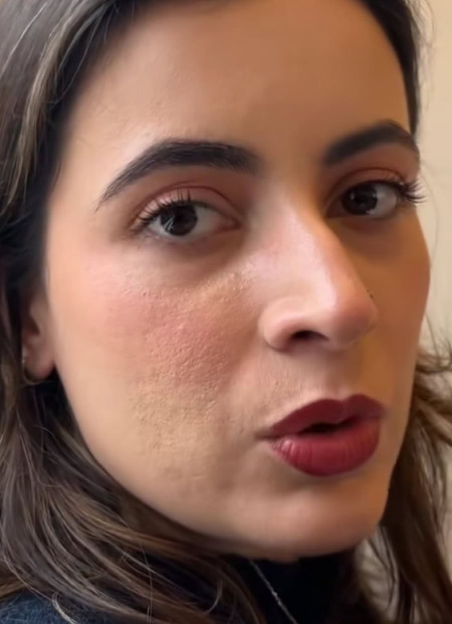 Anya Hamza Ali’s Textured Skin Raises Questions