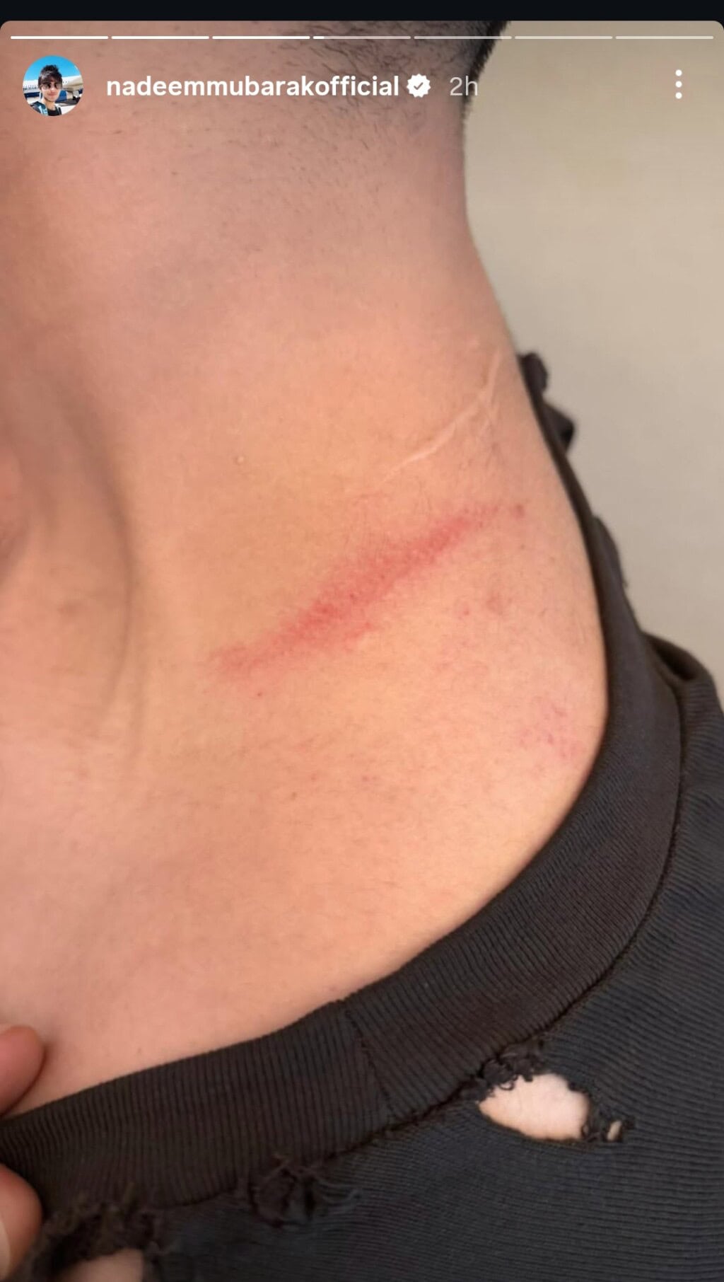 Rajab Butt Gets Attacked in Karachi
