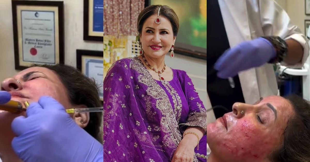 Saba Faisal’s Cosmetic Procedure Video Stuns Fans