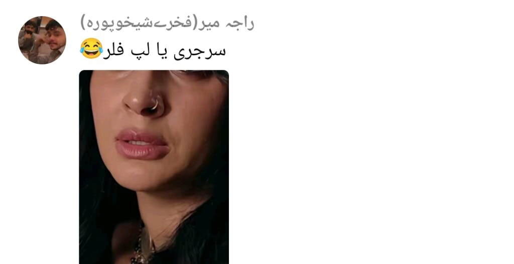 Saba Qamar’s Lip Fillers in Muamma Draw Public Attention