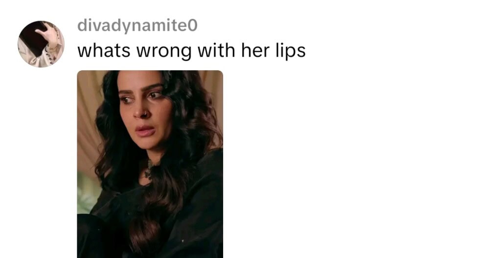 Saba Qamar’s Lip Fillers in Muamma Draw Public Attention