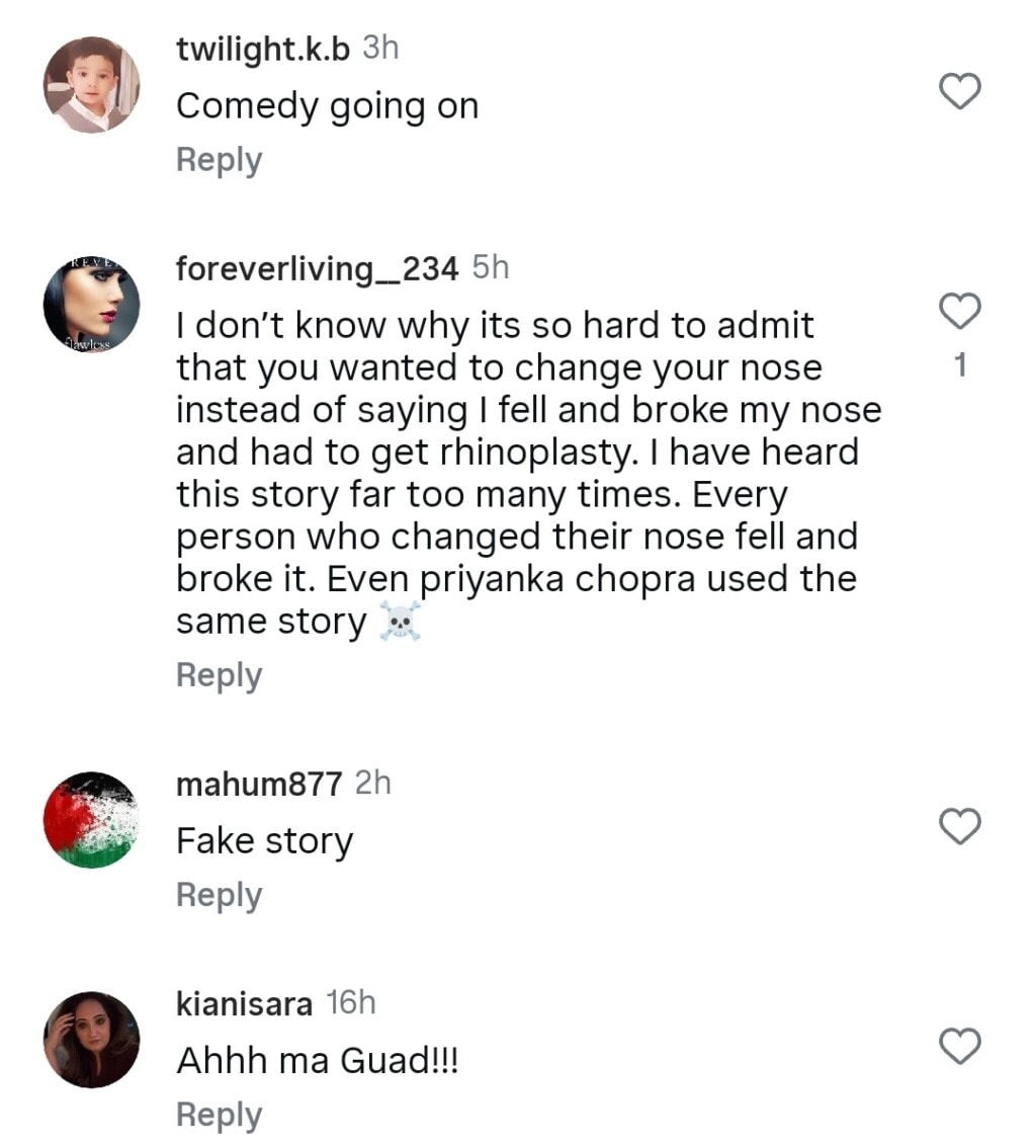 Public Finds Sarwat Gilani’s Nose Job Story Hard to Believe