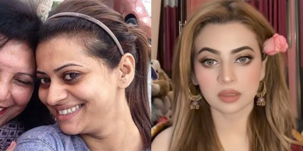 Benita David’s Honest Confession About Getting Whitening Injections