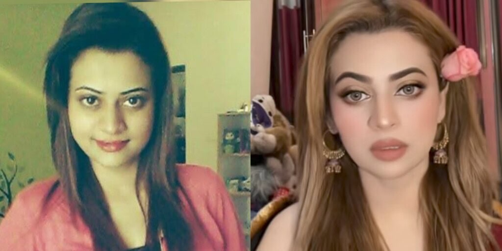 Benita David’s Honest Confession About Getting Whitening Injections