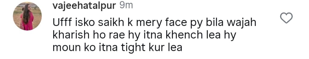 Shaista Lodhi’s Face after Plastic Surgery Disappoints Fans