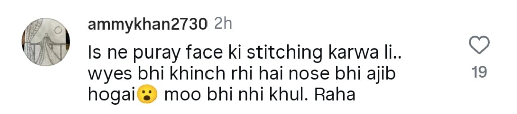 Shaista Lodhi’s Face after Plastic Surgery Disappoints Fans