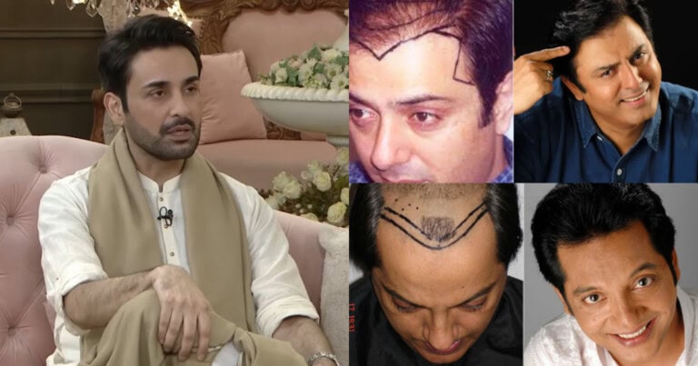 Affan Waheed Shares Thoughts On Cosmetic Surgery