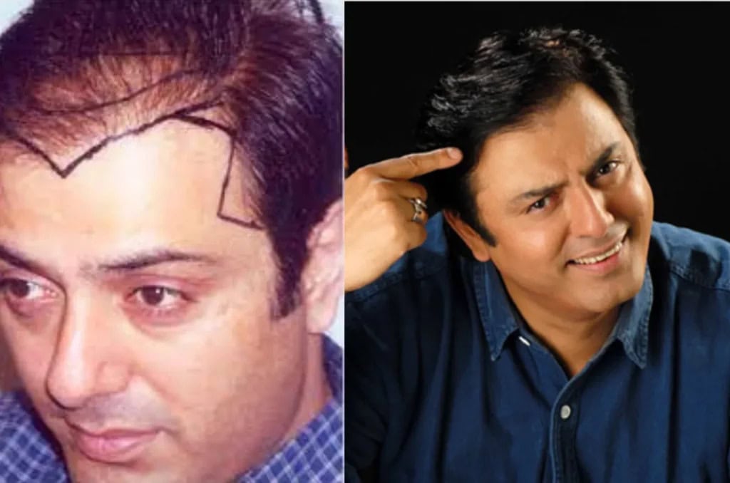 Affan Waheed Shares Thoughts On Cosmetic Surgery