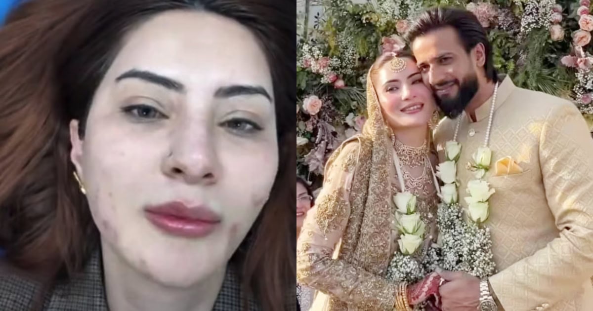 Imad Wasim’s Second Wife Nyla Rajah’s Real Skin Trolled