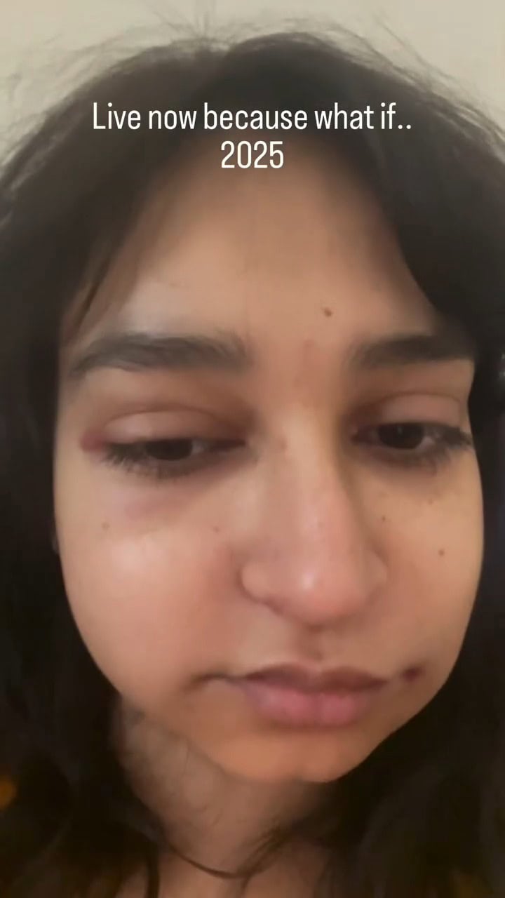 Mamya Shajaffar Bravely Shares Painful Diagnosis