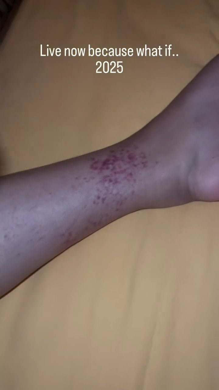 Mamya Shajaffar Bravely Shares Painful Diagnosis