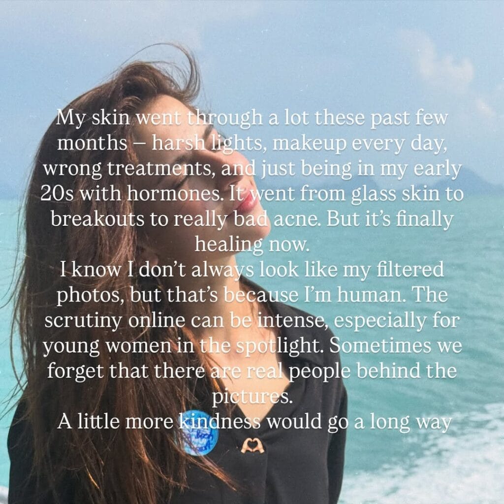 Dananeer Mobeen’s Honest Take on Skin Imperfections Wins Praise