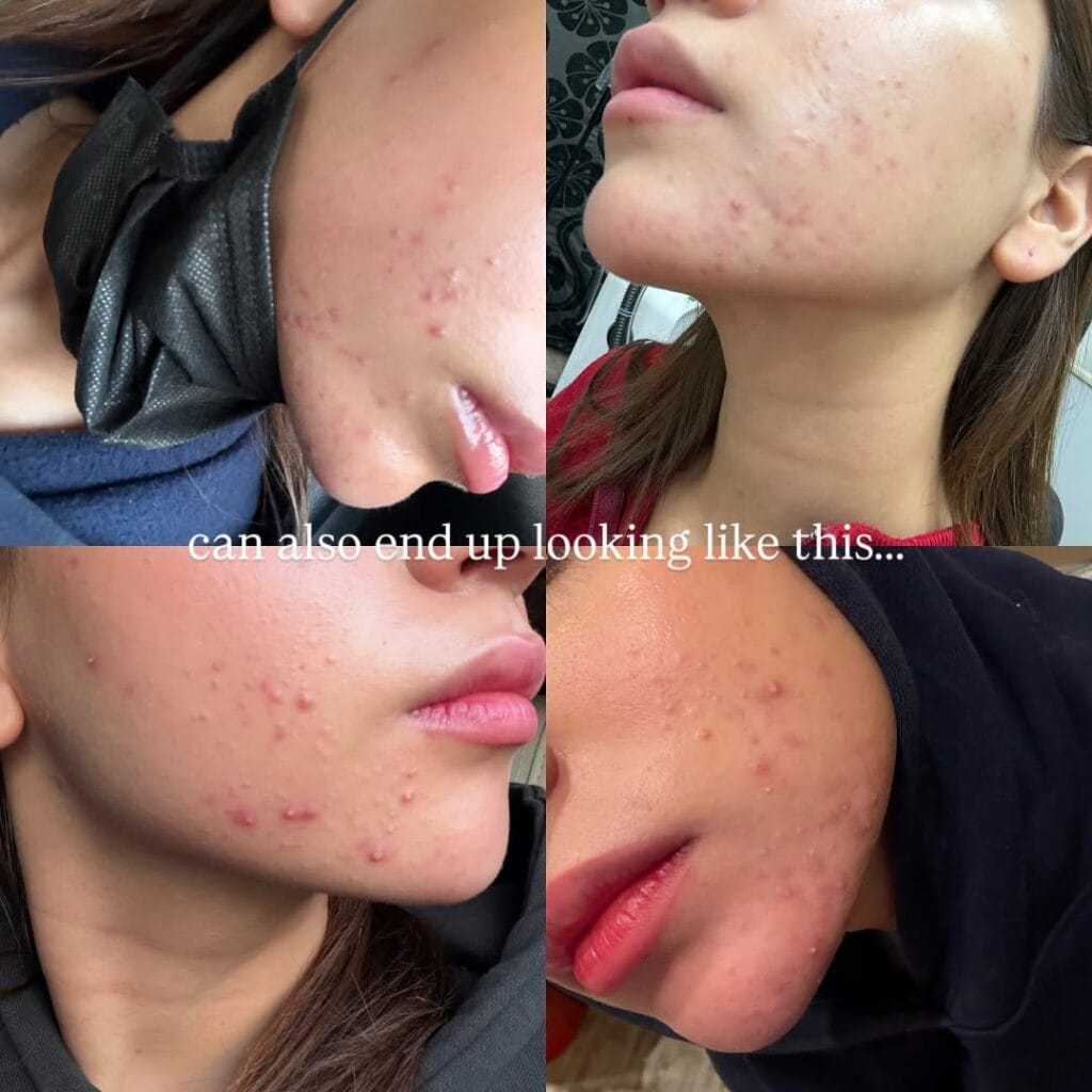 Dananeer Mobeen’s Honest Take on Skin Imperfections Wins Praise