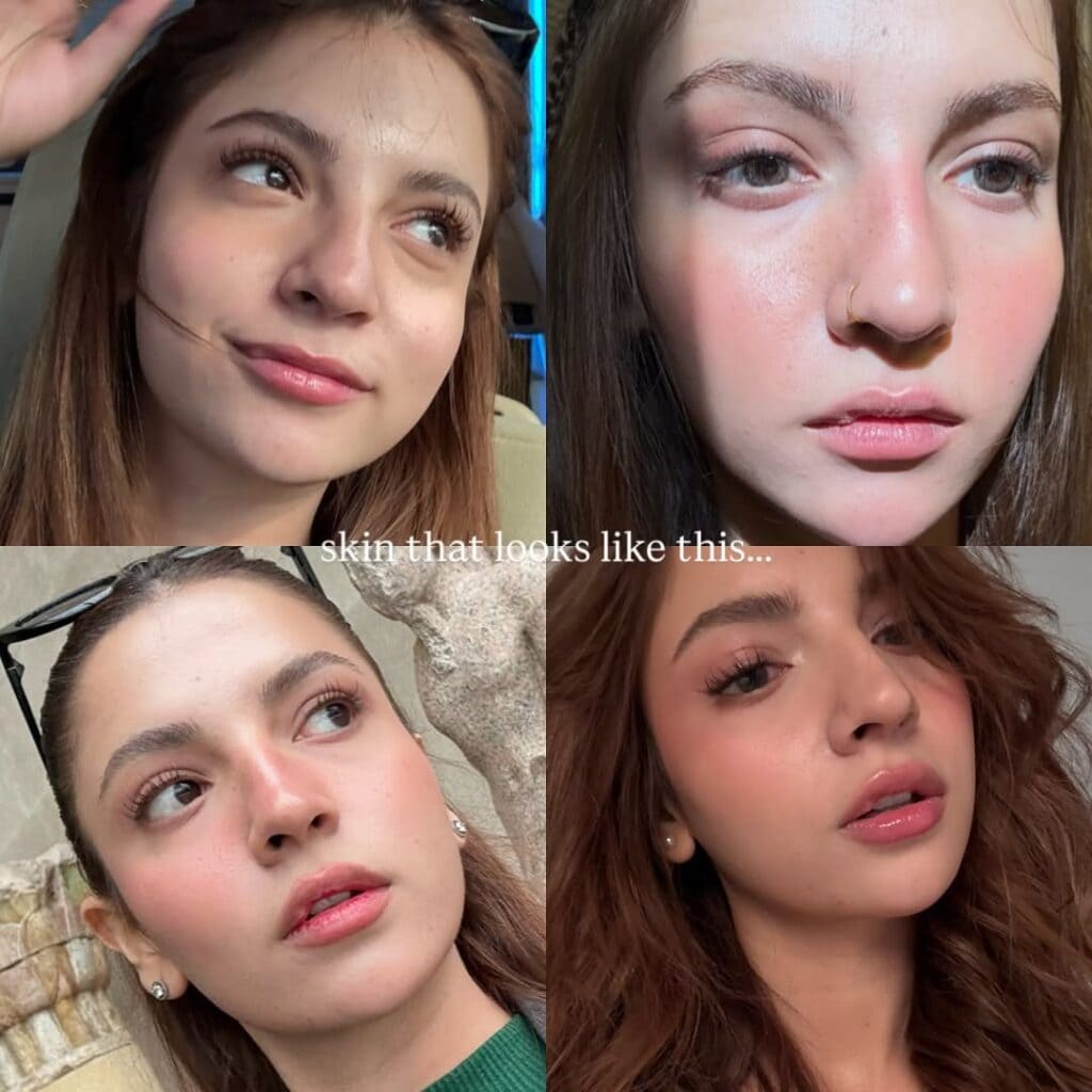 Dananeer Mobeen’s Honest Take on Skin Imperfections Wins Praise
