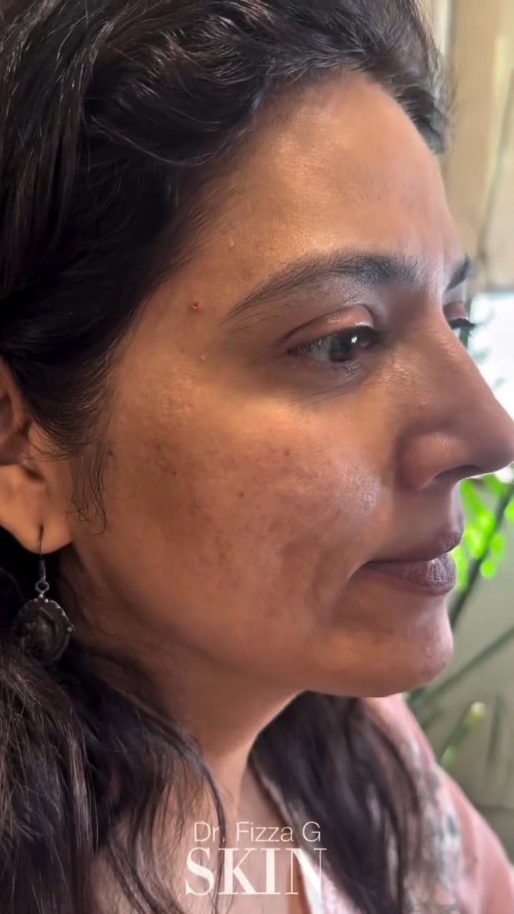 Savera Nadeem Applauded For Showing Her Real Skin
