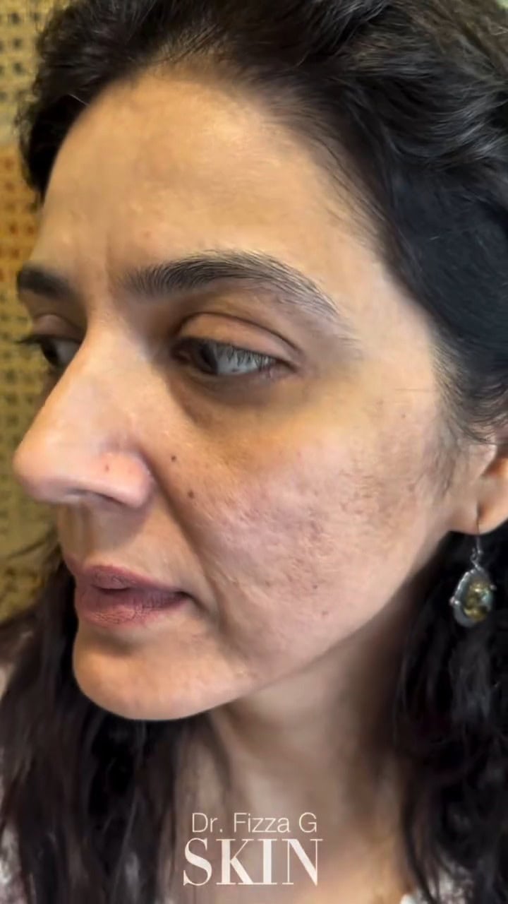 Savera Nadeem Applauded For Showing Her Real Skin