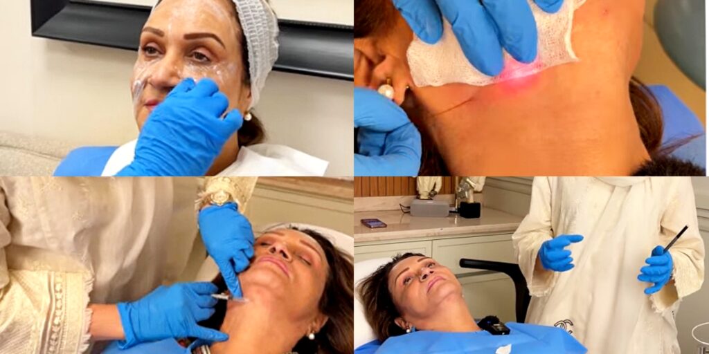 Bushra Ansari's Cosmetic Procedure - Recent Video Bushra Ansari’s Cosmetic Procedure – Recent Video