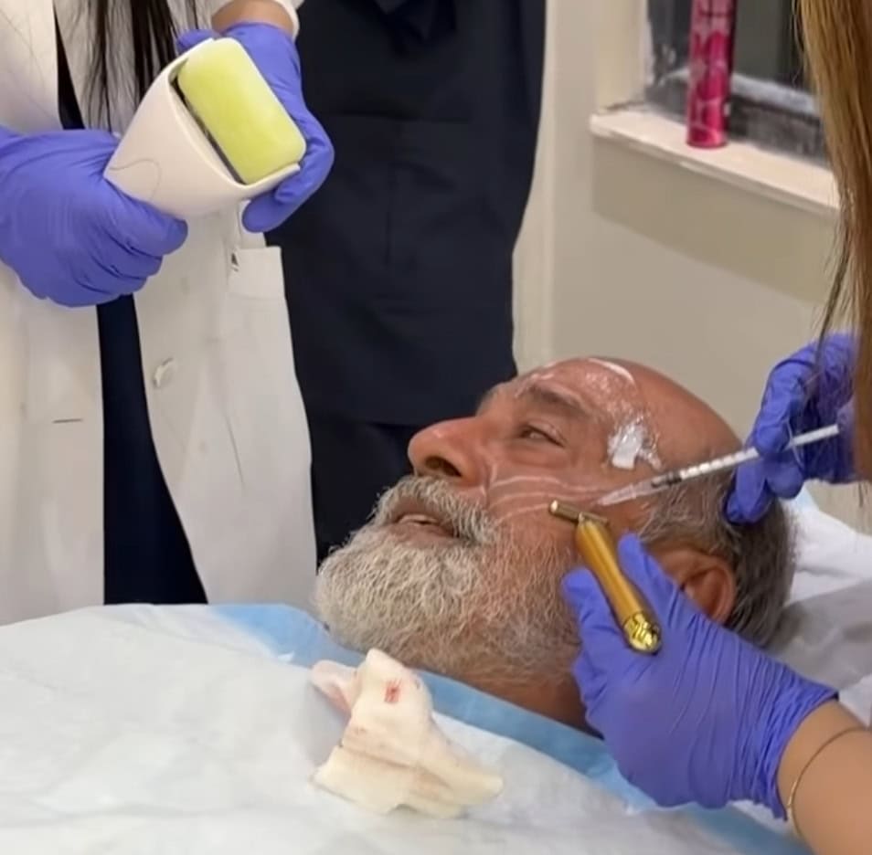 Mohammad Ahmed Undergoes Face Lift Procedure