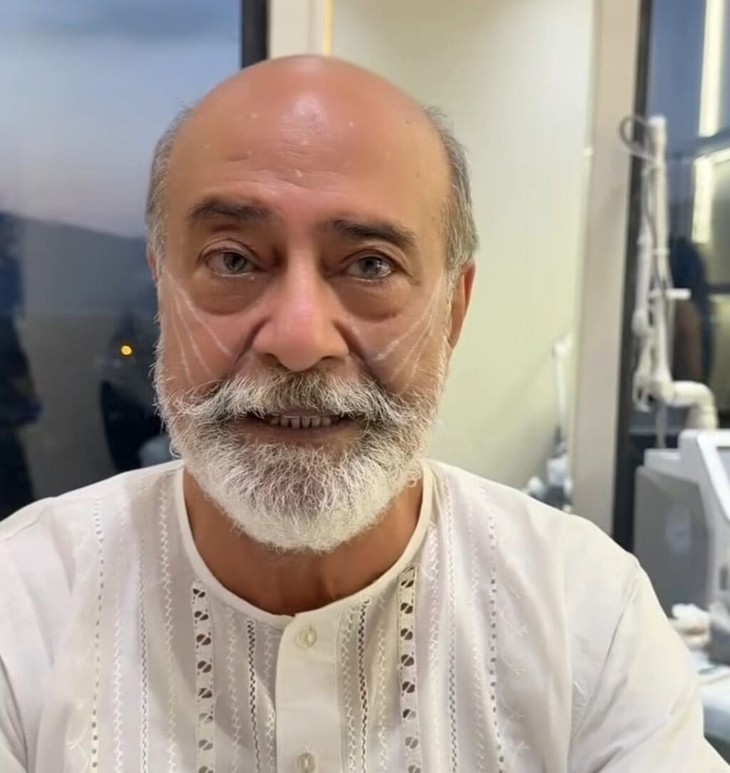 Mohammad Ahmed Undergoes Face Lift Procedure