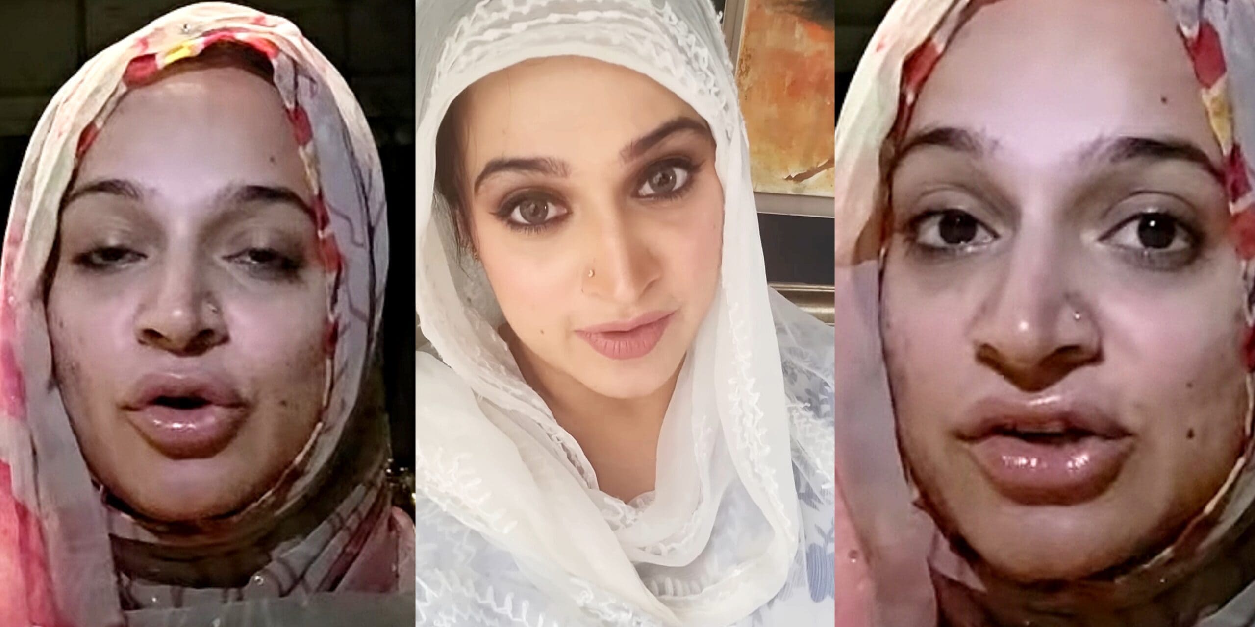 Noor Bukhari’s Lip Fillers Ignite Backlash