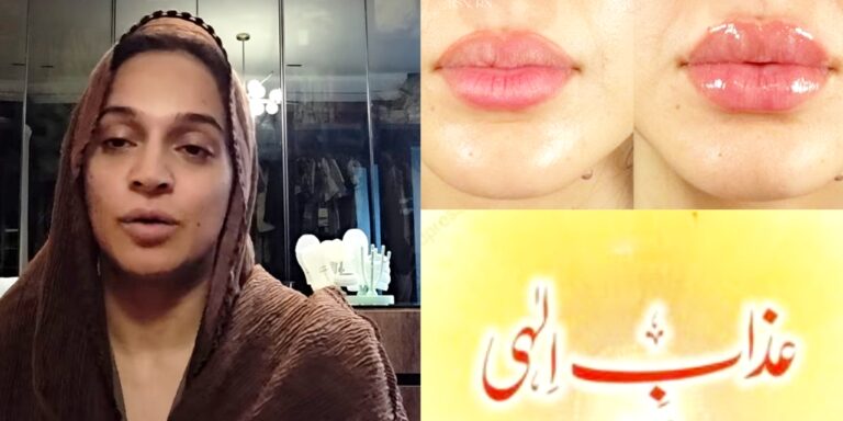 Noor Bukhari Warns Netizens of “Azaab” After Lip Fillers Criticism