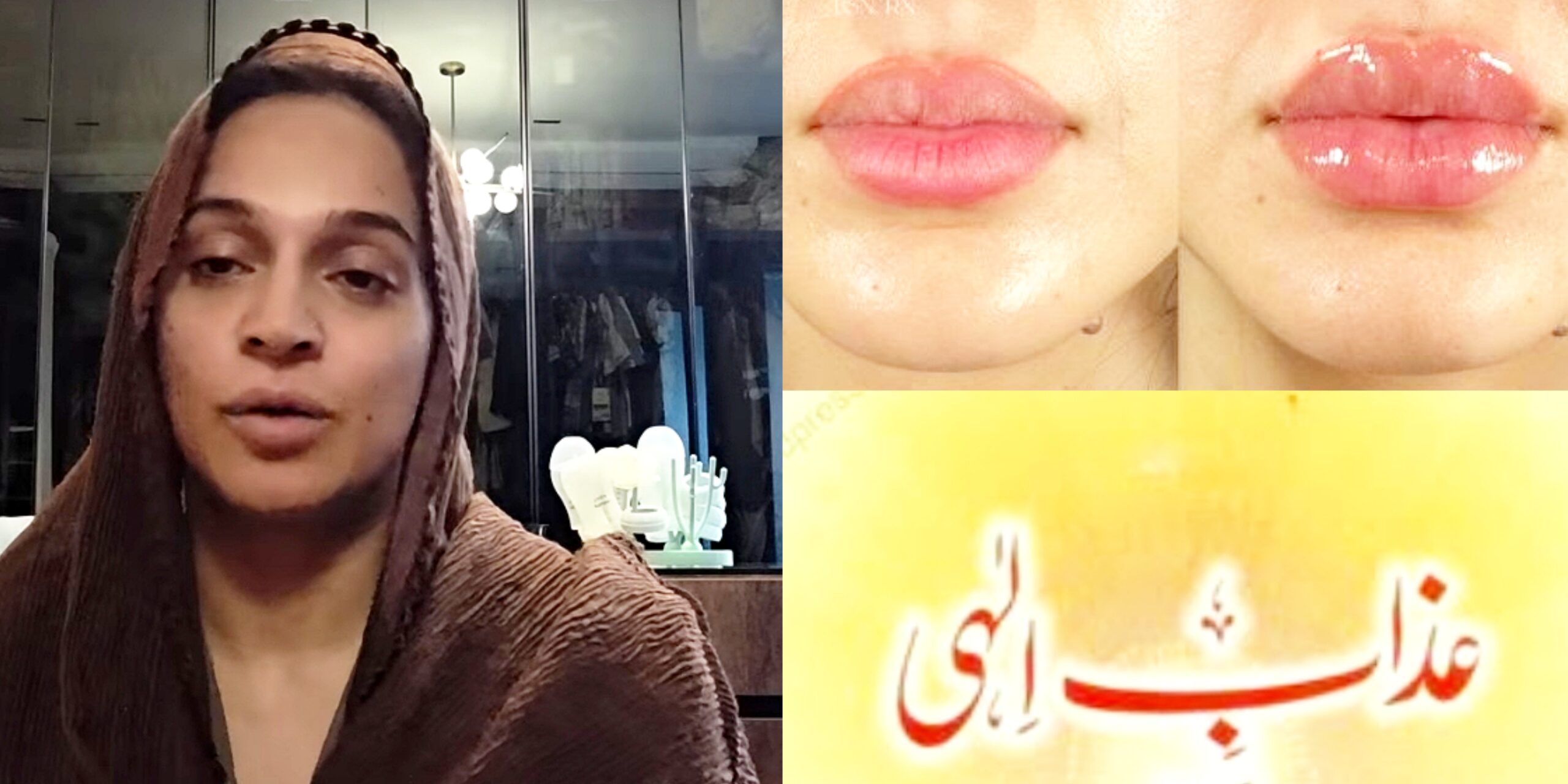 Noor Bukhari Warns Netizens of “Azaab” After Lip Fillers Criticism