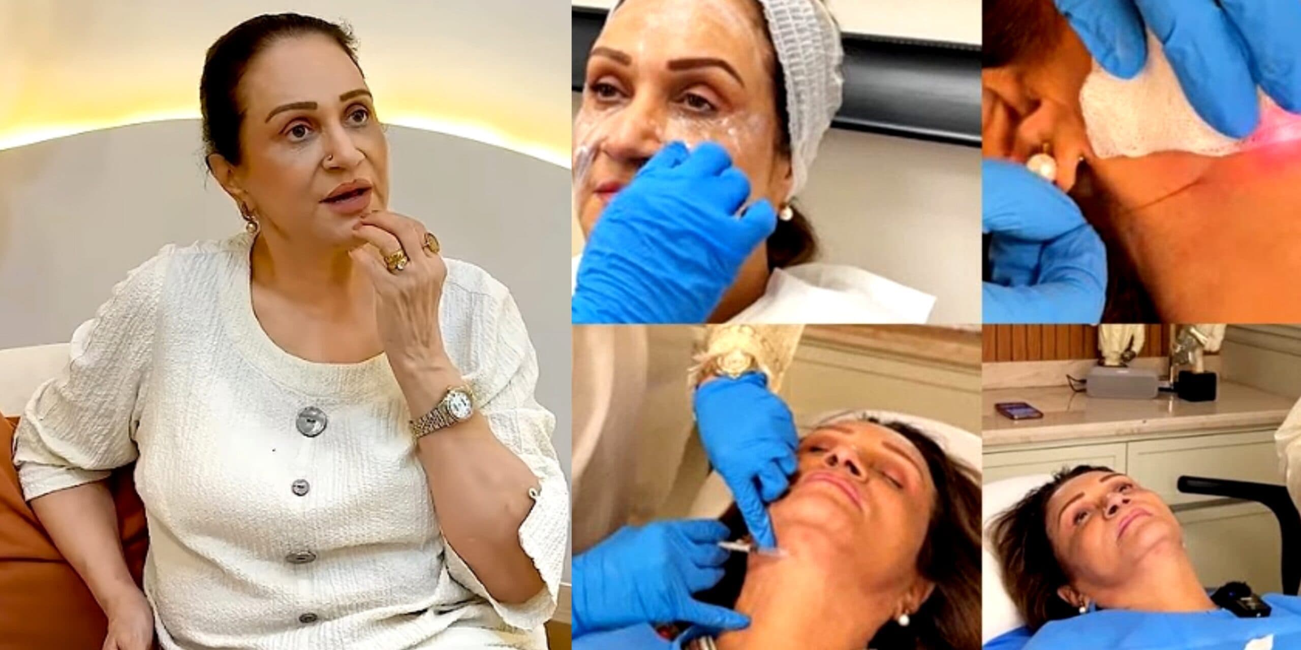 Bushra Ansari Opens Up About Her Failed Botox Treatment